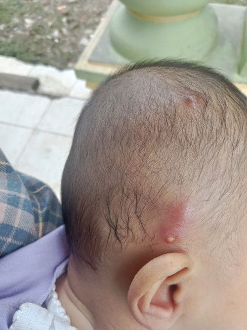 Assalamualaikum mom..ada yang pernah mengalami bayinya begini?  Itu kenapa ya mom?