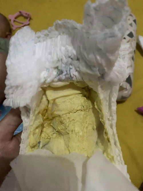 Ciri2 diare seperti apa?