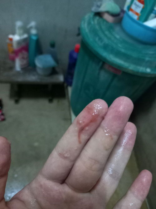 อายุครรภ์37+3วีค