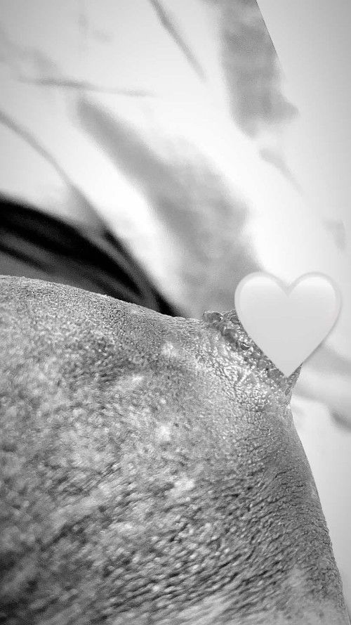 สายปั้มนม หัวนมมีตุ่มใส