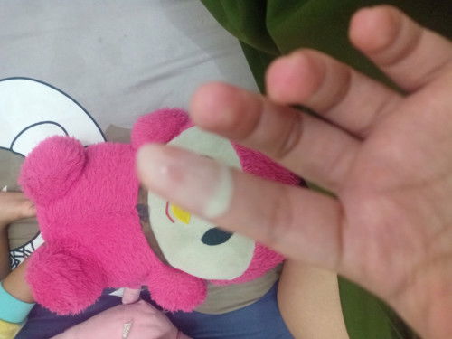 Bahaya / Tidak Hamil 30 Minggu