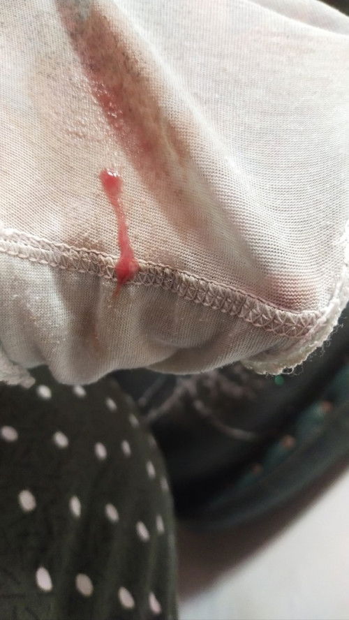 ngeflek hpl 4 February