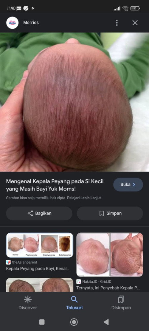 Baby menyusu sebelah saja