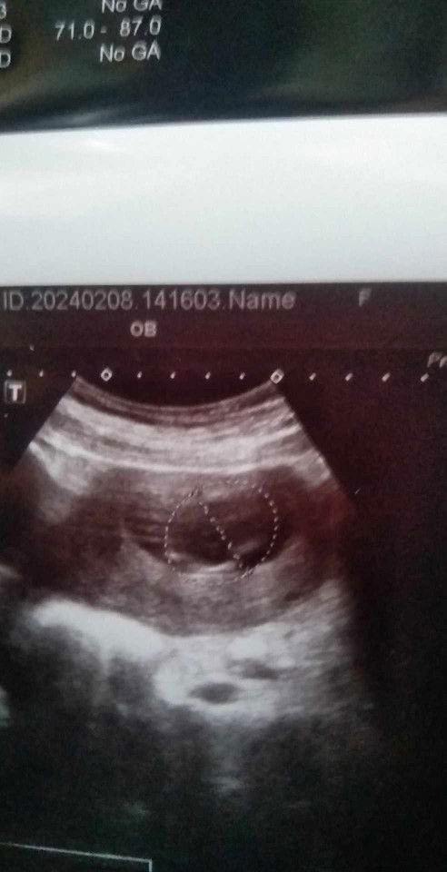 อยากทราบเรื่องเรานับได้16,วิคเเต่หมอบอกเมื่อวาน14+2วิคเราต้องนับสัปดาห์ใหม่ใหมคะ