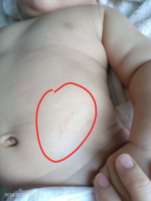 Apa ya kat perut anak saya ni??