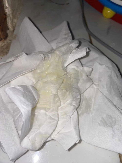 Keputihan berwarna kuning