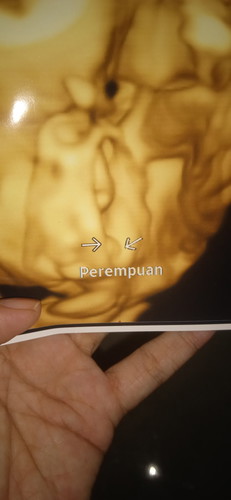 Jenis kelamin perempuan