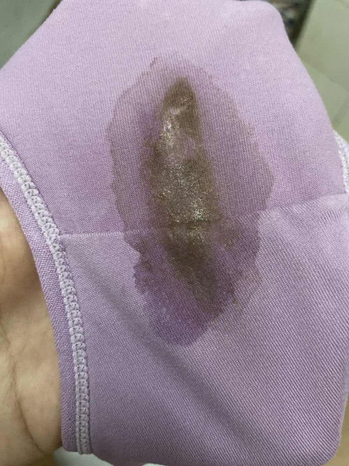 Adakah ini lendir yang dimaksudkn tanda nak bersalin? 39w1d