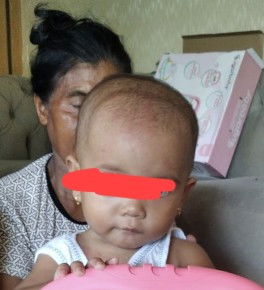 Kepala bayi seperti bando