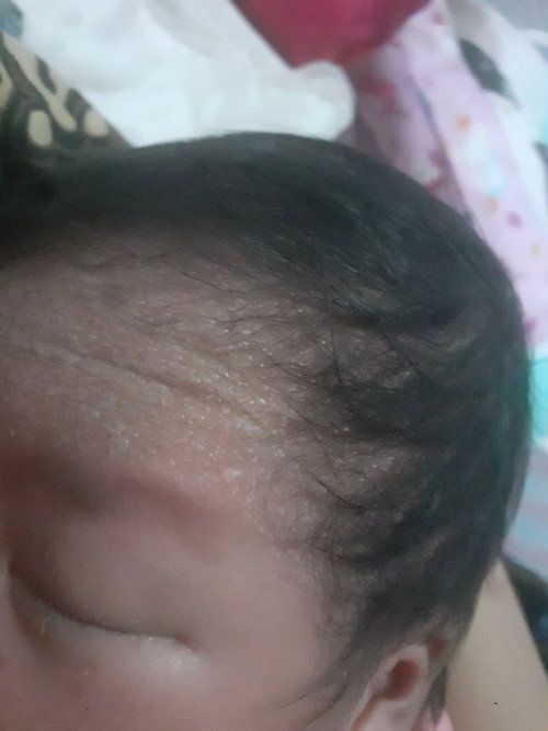 Bayi 7 hari
