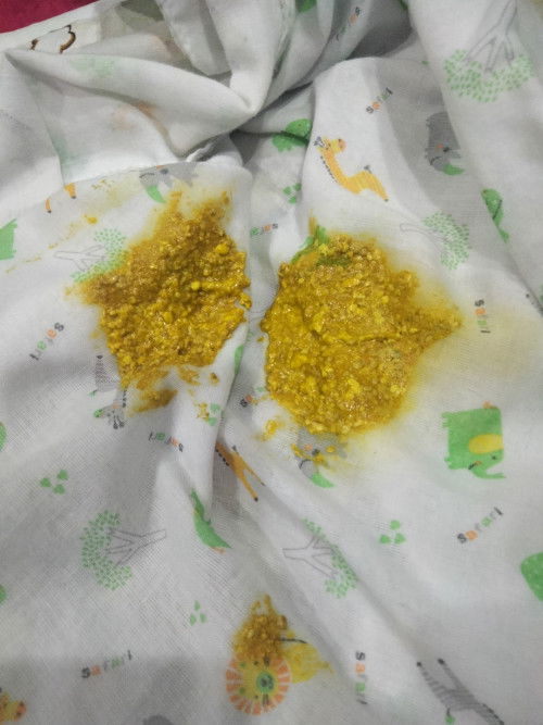 น้องกินนมผสม นมแม่ 20% นมผม 80% อึแบบนี้ปกติไหมค่ะ