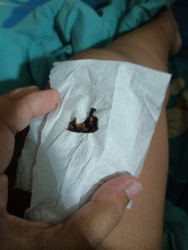 มูกแบบนี้อันตรายไหม