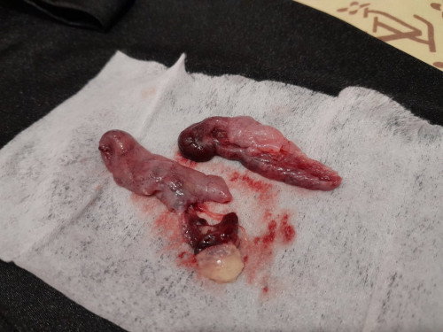 TW: MISCARRIAGE