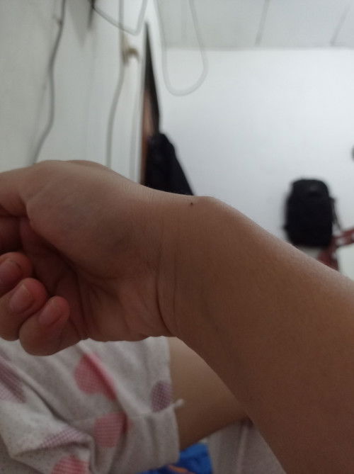 Ngeri di pergelangan tangan