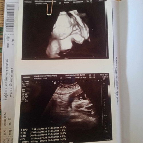 เเม่ช่วยดูหน่อยจ้า