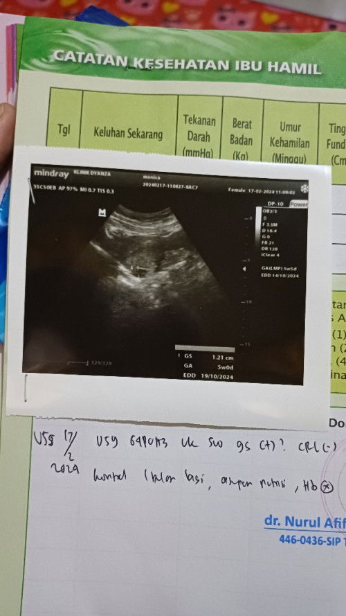 Wajarkah Hamil Usia 5w Kantung Terlihat Kecil?