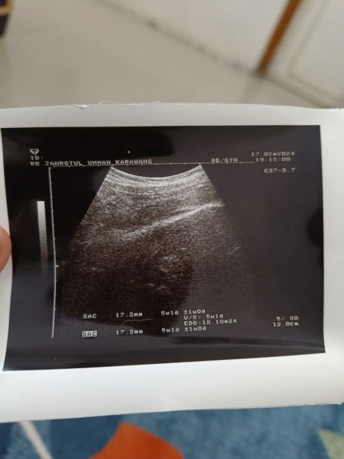 Ciri ciri janin tidak berkembang