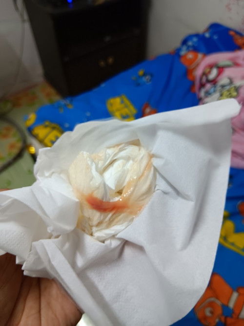 สอบถามแม่ๆคะอาการแบบนี้ควรไปหาหมอเลยมั้ยคะ