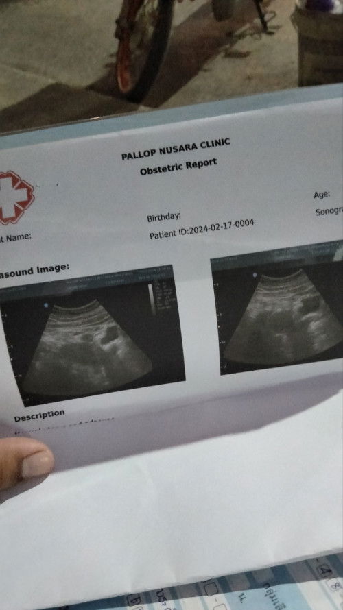 แบบนี้คือไม่ท้องแล้วใช่ไหมค่ะ