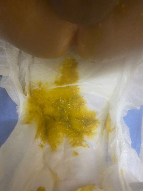 Pertanyaan mengenai najis bayi 4bulan 28hari