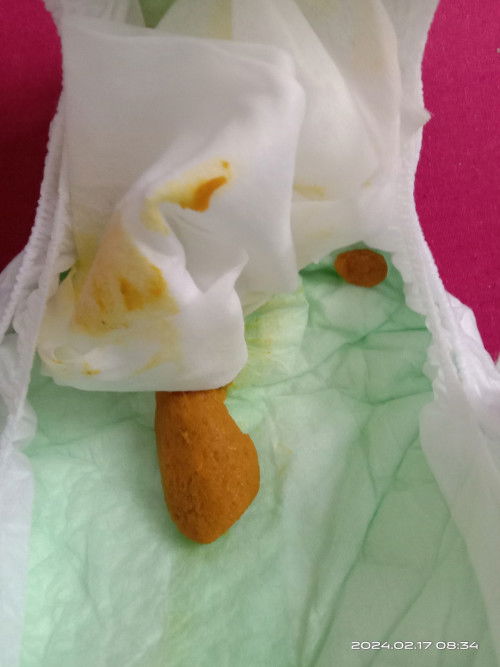 NAJIS BABY KETUL? NORMAL KE?