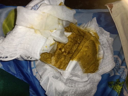 Bé đi phân như vậy có sao không ạ