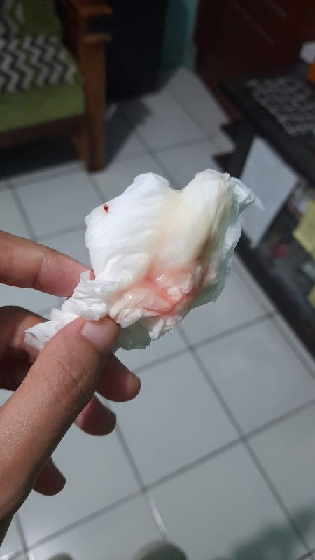 HB setelah keluar flek UK 38 W