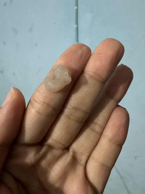 ปวดท้องน้อย มีมูกใส เป็นอะไรคะจะเป็นเมนรึป่าว