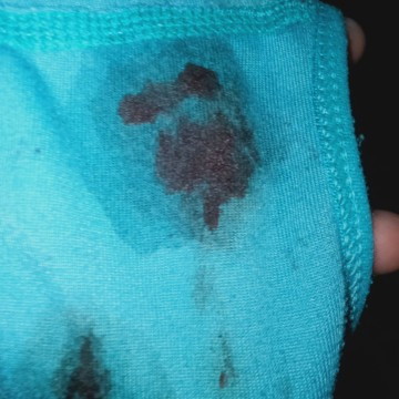 Tadi malam flek trus tadi pagi juga .apa itu pertanda hamil . Setiap saya testpack hasilnya negatif