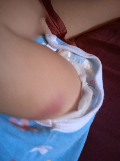 Ask ko lang paano mawawala ito