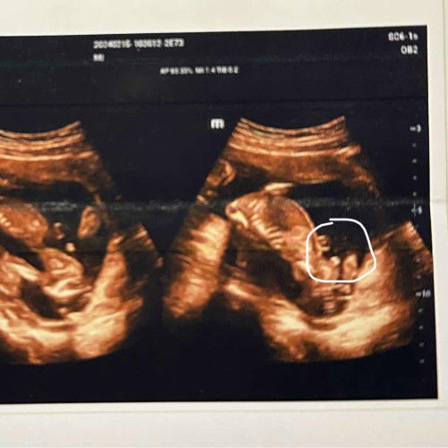 แบบนี้ผู้ชายหรือผู้หญิง