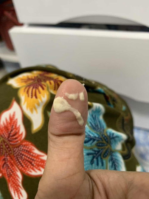 ปั้มนมแล้วมีไขสีขาวๆออกมาคืออะไรคะ