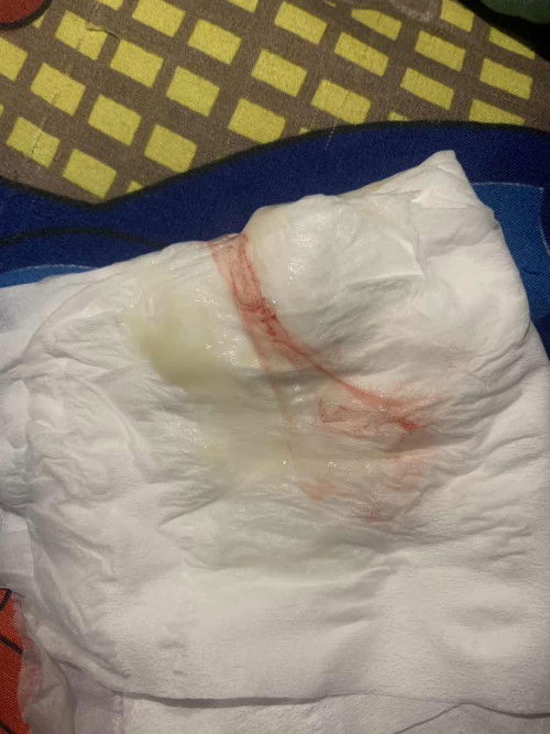 มีมูกเลือดออก 38+4week