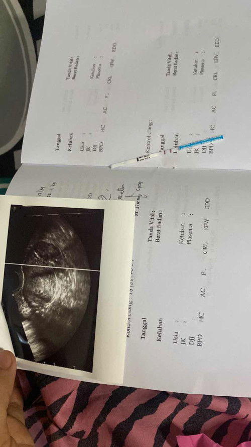 6w3d hanya penebalan rahim