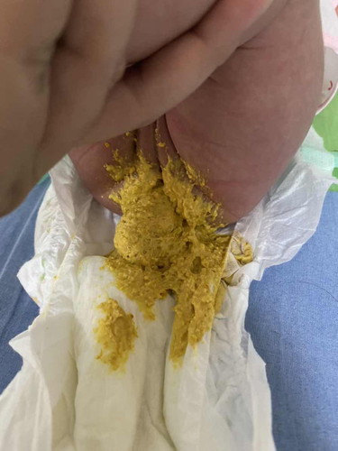 ลูกน้อย28 วัน กินนมผง