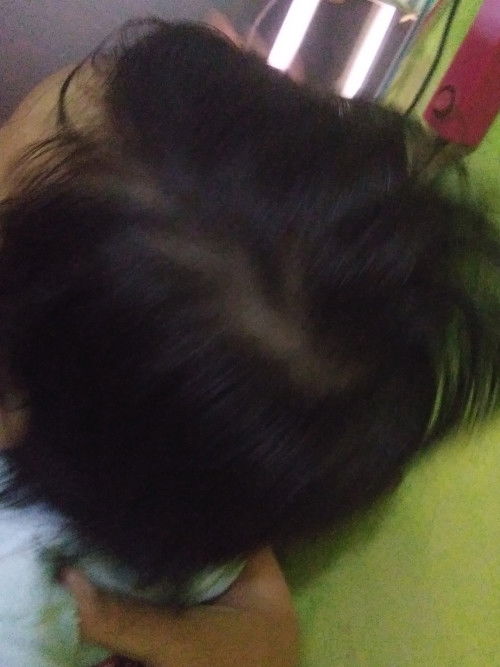 Rambut bayi