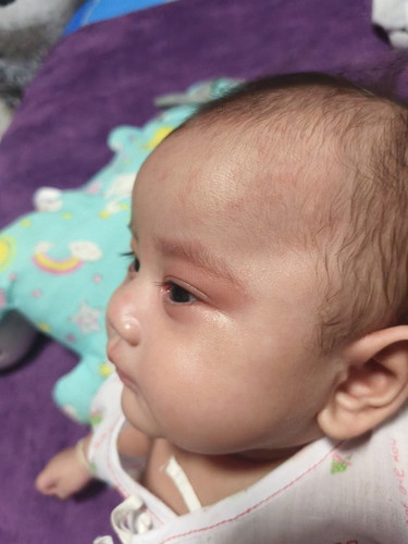 ลูกใครเป็นแบบนี้บ้างคะ ใครพอจะทราบบ้าง