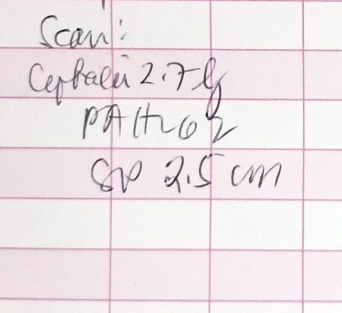 Ano po ba yung meaning ng SP sa ultrasound scan?