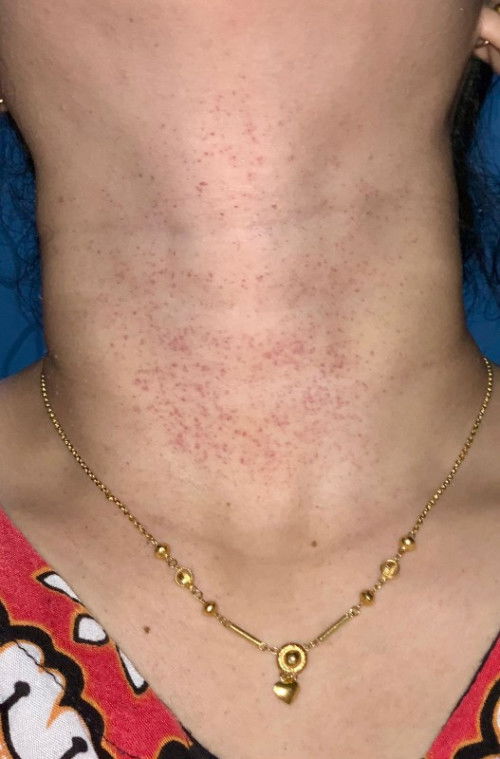 Ada yang sama nggk bun?