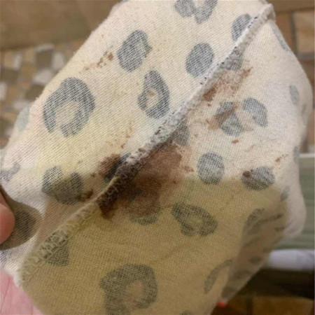 แม่ท้อง 38+1วัน