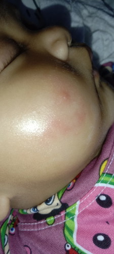 Buklid s mukha