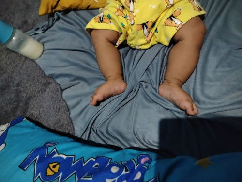 Bentuk kaki bayi