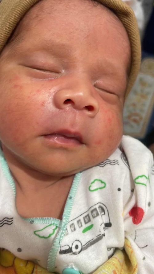 Wajah Bayi usia 2 minggu