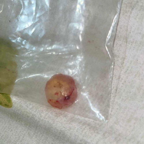 Janin tidak berkembang