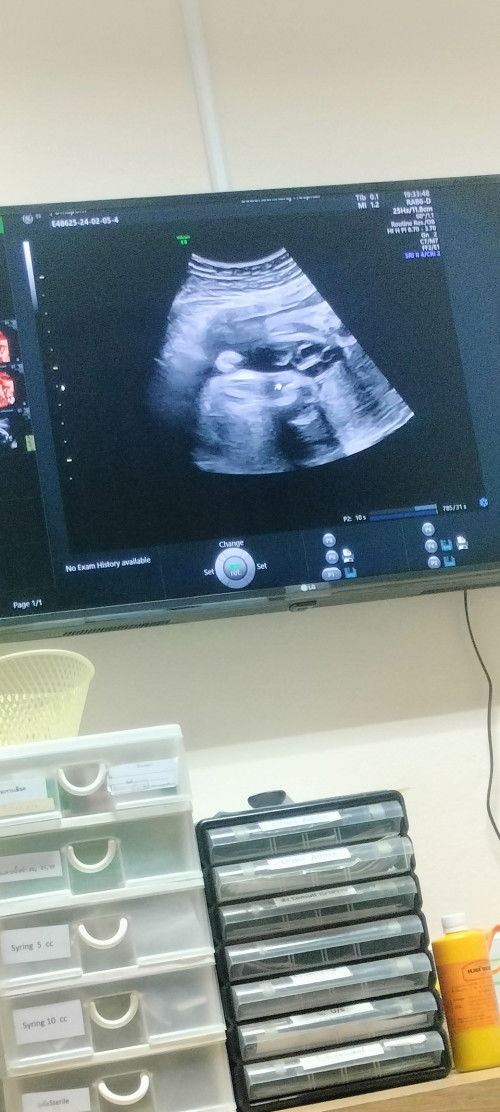 เพศลูกสาวแบบนี้100% ใม๊ค่ะ