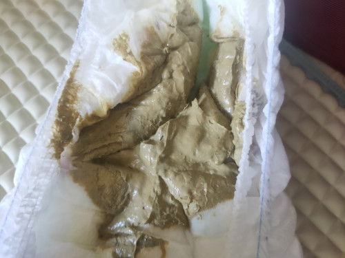 Normal ke najis baby fm macam ni