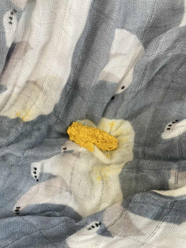 ลูกกินนมแม่+นมผงสลับกัน ลักษณะอุจจาระแบบนี้ปกติมั้ย