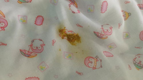 แม่ๆคะน้องเยี่ยวแล้วมีอึหยอดด้วยแบบนี้เรียกว่าท้องเสียรึป่าวคะ