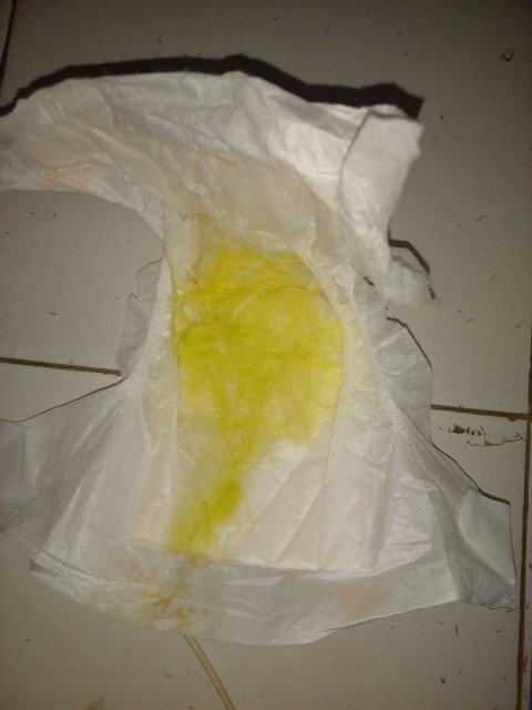 Diare atau tidak