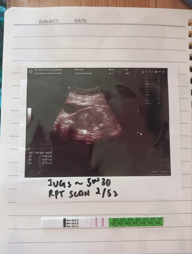 Confirm Pregnancy